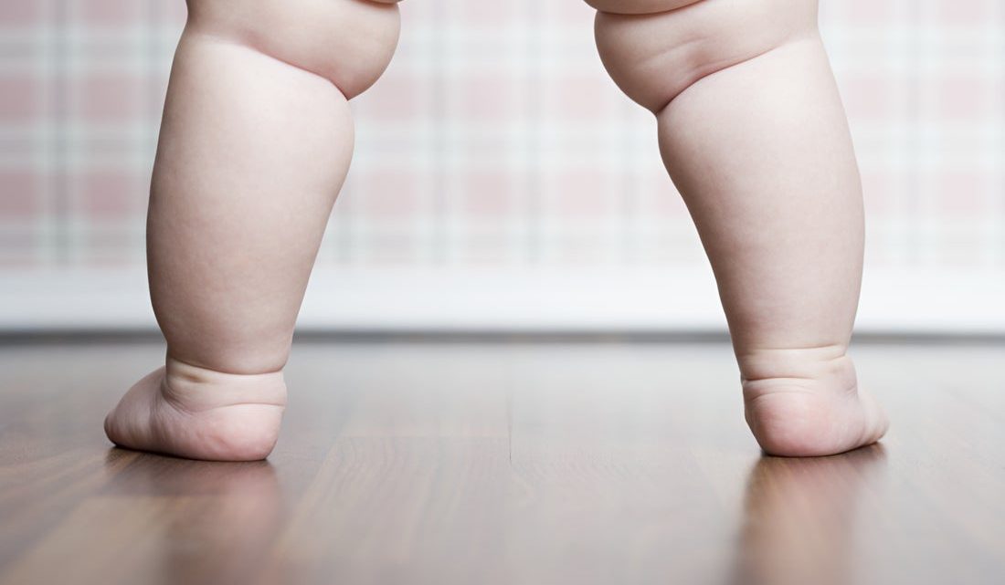 Несимметричные складки на ножках младенца: норма или поводу бежать к врачу?