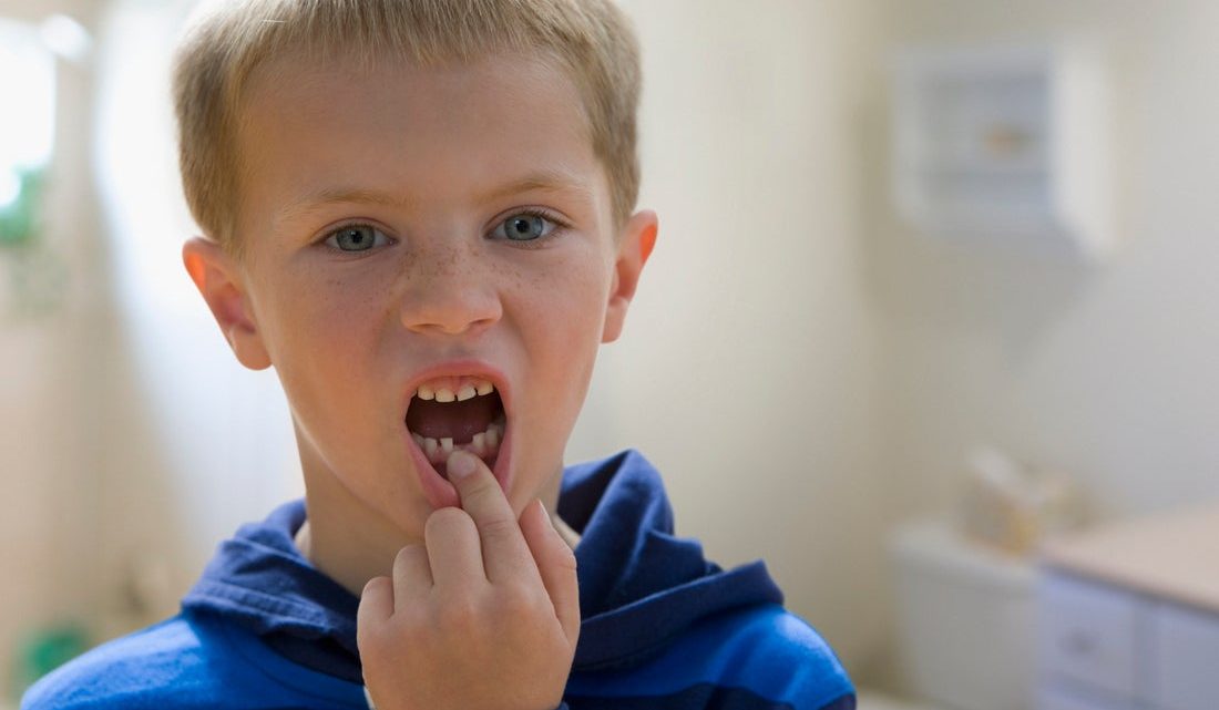 Скололся зуб у ребенка: что делать родителям