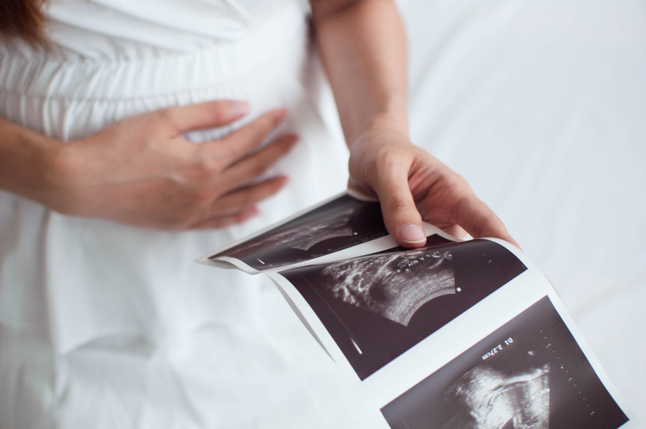 Подменили эмбрион: женщина выносила чужого ребенка из-за ошибки врачей