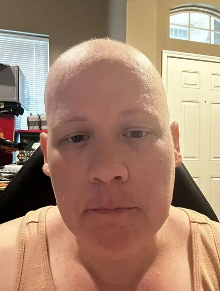«Мне сказали, что через 15 месяцев я умру»: пройдя химиотерапию, 39-летняя женщина узнала, что у нее никогда не было рака